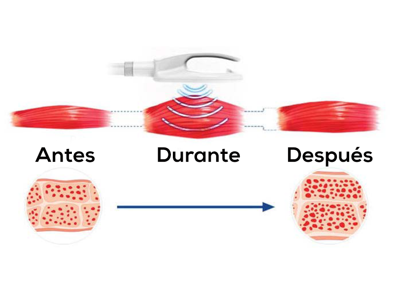 recorrido del antes, durante y después